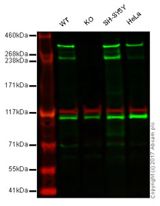Western blot - Anti-Huntingtin antibody [EP867Y] - BSA and Azide free (AB225573)