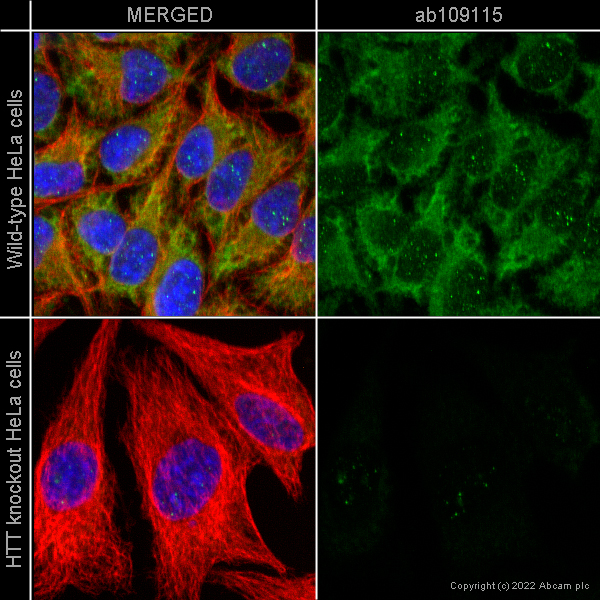 Immunocytochemistry/ Immunofluorescence - Anti-Huntingtin antibody [EPR5526] (ab109115), expandable thumbnail