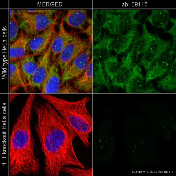 Immunocytochemistry/ Immunofluorescence - Anti-Huntingtin antibody [EPR5526] (AB109115)