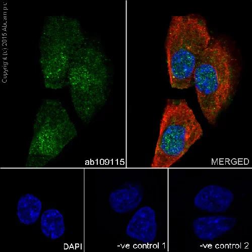Immunocytochemistry/ Immunofluorescence - Anti-Huntingtin antibody [EPR5526] (AB109115)