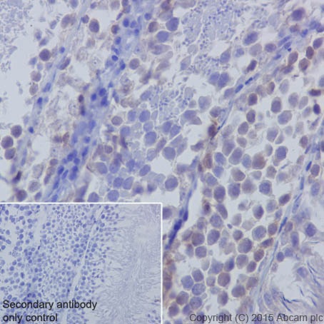 Immunohistochemistry (Formalin/PFA-fixed paraffin-embedded sections) - Anti-Huntingtin antibody [EPR5526] (ab109115), expandable thumbnail