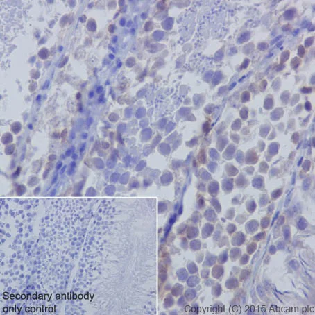 Immunohistochemistry (Formalin/PFA-fixed paraffin-embedded sections) - Anti-Huntingtin antibody [EPR5526] (AB109115)