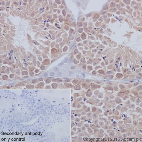 Immunohistochemistry (Formalin/PFA-fixed paraffin-embedded sections) - Anti-Huntingtin antibody [EPR5526] (ab109115), expandable thumbnail