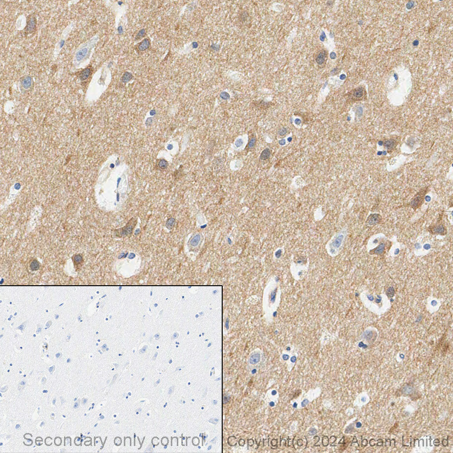 Immunohistochemistry (Formalin/PFA-fixed paraffin-embedded sections) - Anti-Huntingtin antibody [EPR5526] (ab109115), expandable thumbnail