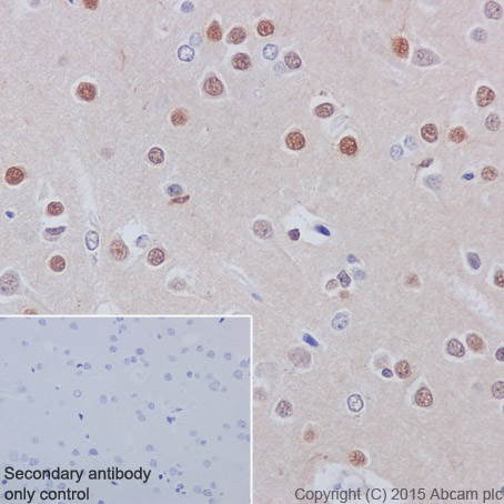Immunohistochemistry (Formalin/PFA-fixed paraffin-embedded sections) - Anti-Huntingtin antibody [EPR5526] (ab109115), expandable thumbnail