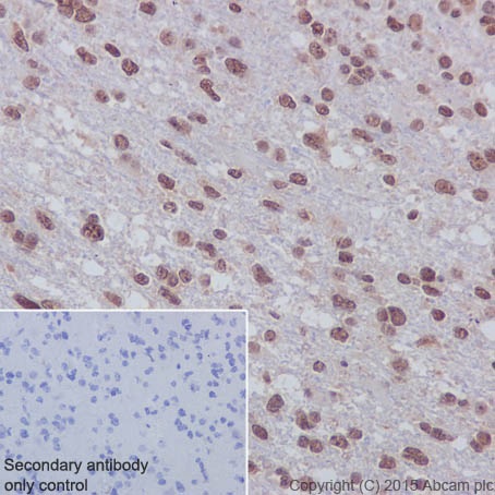 Immunohistochemistry (Formalin/PFA-fixed paraffin-embedded sections) - Anti-Huntingtin antibody [EPR5526] (AB109115), expandable thumbnail