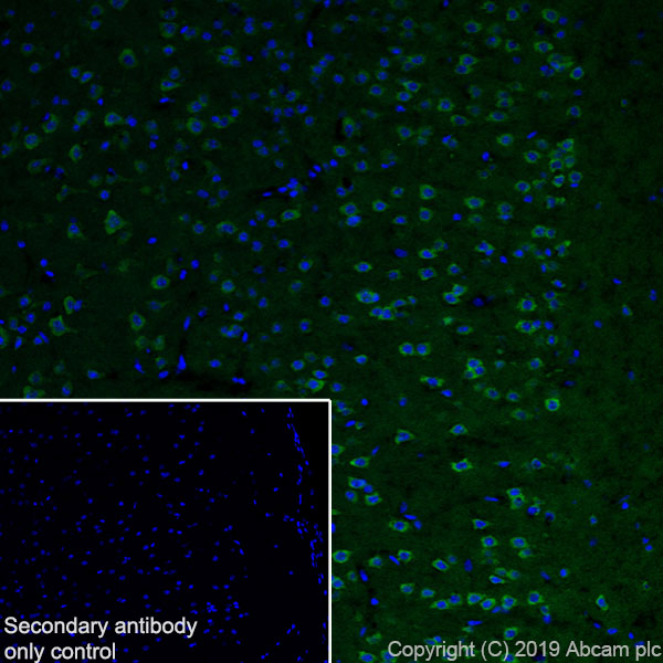 Immunohistochemistry (PFA perfusion fixed frozen sections) - Anti-Huntingtin antibody [EPR5526] (ab109115), expandable thumbnail