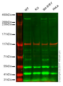 Western blot - Anti-Huntingtin antibody [EPR5526] (AB109115), expandable thumbnail