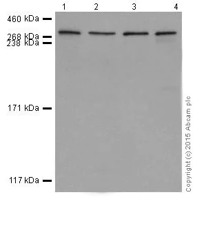 Western blot - Anti-Huntingtin antibody [EPR5526] (AB109115)