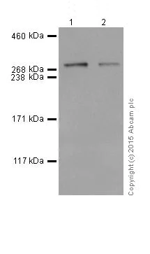 Western blot - Anti-Huntingtin antibody [EPR5526] (AB109115)
