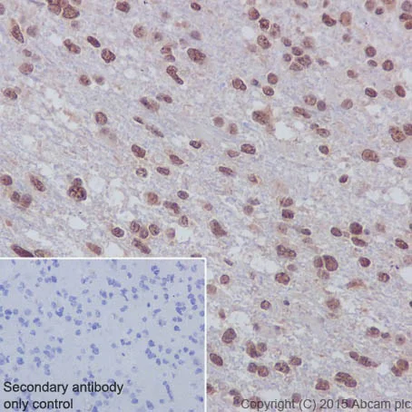 Immunohistochemistry (Formalin/PFA-fixed paraffin-embedded sections) - Anti-Huntingtin antibody [EPR5526] - BSA and Azide free (AB209668)