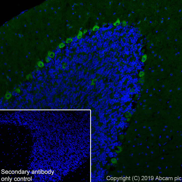 Immunohistochemistry (PFA perfusion fixed frozen sections) - Anti-Huntingtin antibody [EPR5526] - BSA and Azide free (AB209668)