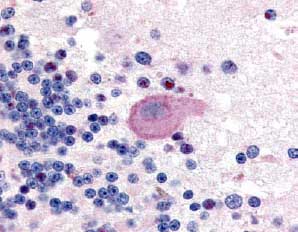 Immunohistochemistry (Formalin/PFA-fixed paraffin-embedded sections) - Anti-Huntingtin (phospho S421) antibody (AB2174), expandable thumbnail