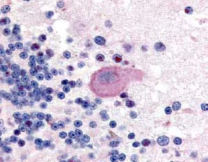 Immunohistochemistry (Formalin/PFA-fixed paraffin-embedded sections) - Anti-Huntingtin (phospho S421) antibody (AB2174)