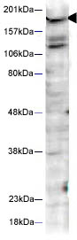 Western blot - Anti-Huntingtin (phospho S421) antibody (AB2174), expandable thumbnail