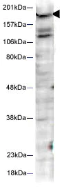 Western blot - Anti-Huntingtin (phospho S421) antibody (AB2174)