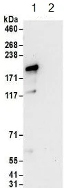 Immunoprecipitation - Anti-hUPF2/RENT2 antibody (AB157108)
