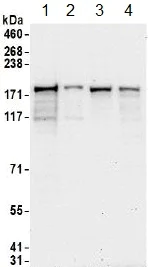 Western blot - Anti-hUPF2/RENT2 antibody (AB157108)