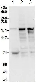 Western blot - Anti-hUPF2/RENT2 antibody (AB157108)