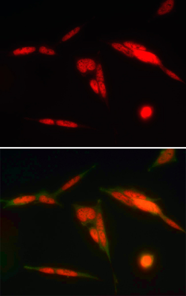 Immunocytochemistry/ Immunofluorescence - Anti-HuR / ELAVL1 antibody [19F12AE12] (ab170193), expandable thumbnail