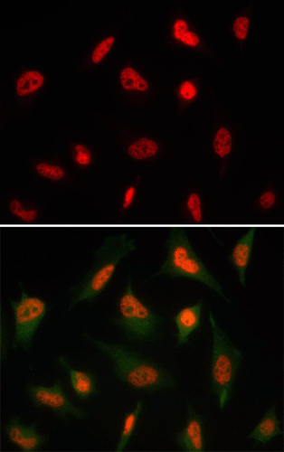 Immunocytochemistry/ Immunofluorescence - Anti-HuR / ELAVL1 antibody [19F12AE12] (AB170193), expandable thumbnail