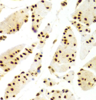 Immunohistochemistry (Formalin/PFA-fixed paraffin-embedded sections) - Anti-HuR / ELAVL1 antibody (ab238528), expandable thumbnail