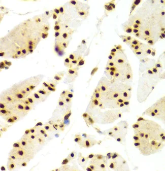 Immunohistochemistry (Formalin/PFA-fixed paraffin-embedded sections) - Anti-HuR / ELAVL1 antibody (AB238528)