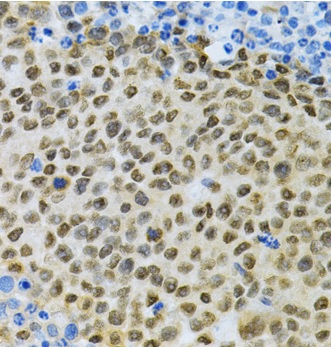 Immunohistochemistry (Formalin/PFA-fixed paraffin-embedded sections) - Anti-HuR / ELAVL1 antibody (ab238528), expandable thumbnail