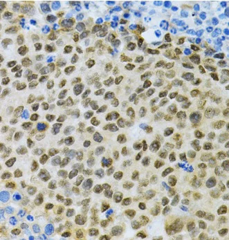 Immunohistochemistry (Formalin/PFA-fixed paraffin-embedded sections) - Anti-HuR / ELAVL1 antibody (AB238528)