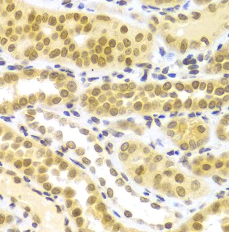 Immunohistochemistry (Formalin/PFA-fixed paraffin-embedded sections) - Anti-HuR / ELAVL1 antibody (AB238528)
