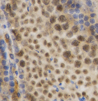 Immunohistochemistry (Formalin/PFA-fixed paraffin-embedded sections) - Anti-HuR / ELAVL1 antibody (AB238528), expandable thumbnail