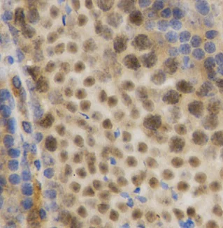 Immunohistochemistry (Formalin/PFA-fixed paraffin-embedded sections) - Anti-HuR / ELAVL1 antibody (AB238528)
