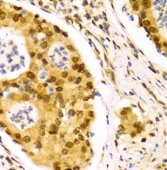 Immunohistochemistry (Formalin/PFA-fixed paraffin-embedded sections) - Anti-HuR / ELAVL1 antibody (ab238528), expandable thumbnail