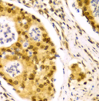 Immunohistochemistry (Formalin/PFA-fixed paraffin-embedded sections) - Anti-HuR / ELAVL1 antibody (AB238528)