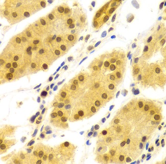 Immunohistochemistry (Formalin/PFA-fixed paraffin-embedded sections) - Anti-HuR / ELAVL1 antibody (ab238528), expandable thumbnail