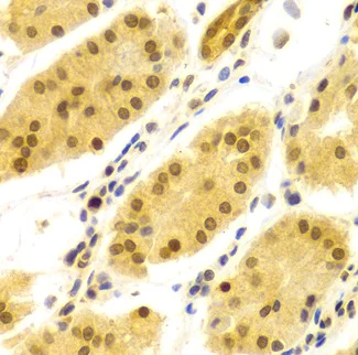 Immunohistochemistry (Formalin/PFA-fixed paraffin-embedded sections) - Anti-HuR / ELAVL1 antibody (AB238528)