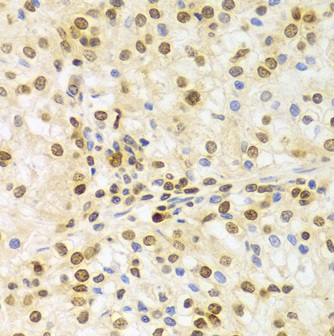 Immunohistochemistry (Formalin/PFA-fixed paraffin-embedded sections) - Anti-HuR / ELAVL1 antibody (ab238528), expandable thumbnail