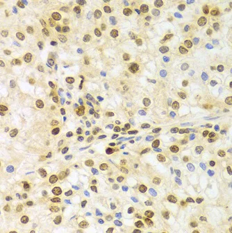 Immunohistochemistry (Formalin/PFA-fixed paraffin-embedded sections) - Anti-HuR / ELAVL1 antibody (AB238528)