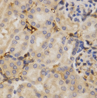 Immunohistochemistry (Formalin/PFA-fixed paraffin-embedded sections) - Anti-HuR / ELAVL1 antibody (ab238528), expandable thumbnail