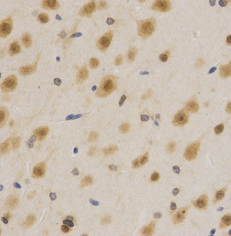 Immunohistochemistry (Formalin/PFA-fixed paraffin-embedded sections) - Anti-HuR / ELAVL1 antibody (ab238528), expandable thumbnail