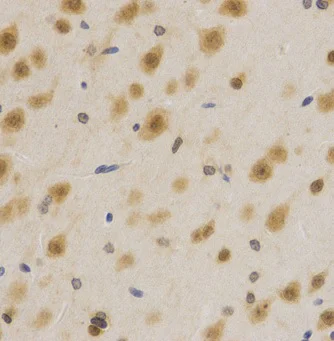 Immunohistochemistry (Formalin/PFA-fixed paraffin-embedded sections) - Anti-HuR / ELAVL1 antibody (AB238528)