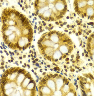 Immunohistochemistry (Formalin/PFA-fixed paraffin-embedded sections) - Anti-HuR / ELAVL1 antibody (AB238528), expandable thumbnail