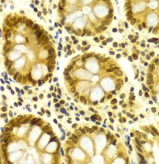 Immunohistochemistry (Formalin/PFA-fixed paraffin-embedded sections) - Anti-HuR / ELAVL1 antibody (AB238528)