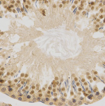 Immunohistochemistry (Formalin/PFA-fixed paraffin-embedded sections) - Anti-HuR / ELAVL1 antibody (AB238528), expandable thumbnail