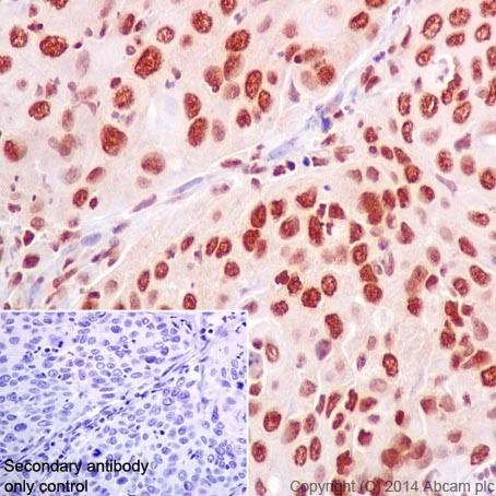 Immunohistochemistry (Formalin/PFA-fixed paraffin-embedded sections) - Anti-HuR / ELAVL1 antibody [EPR17397] (ab200342), expandable thumbnail