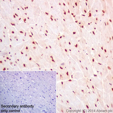 Immunohistochemistry (Formalin/PFA-fixed paraffin-embedded sections) - Anti-HuR / ELAVL1 antibody [EPR17397] (ab200342), expandable thumbnail