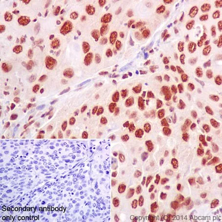 Immunohistochemistry (Formalin/PFA-fixed paraffin-embedded sections) - Anti-HuR / ELAVL1 antibody [EPR17397] - BSA and Azide free (AB242410)