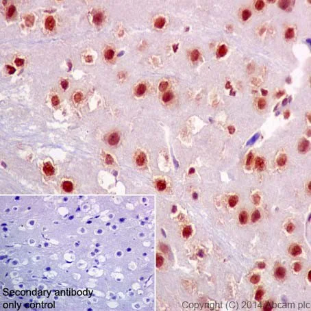 Immunohistochemistry (Formalin/PFA-fixed paraffin-embedded sections) - Anti-HuR / ELAVL1 antibody [EPR17397] - BSA and Azide free (AB242410)
