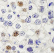 Immunohistochemistry (Formalin/PFA-fixed paraffin-embedded sections) - Anti-HURP antibody (AB84509)