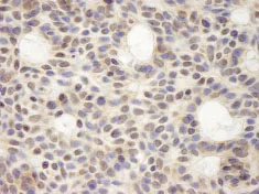 Immunohistochemistry (Formalin/PFA-fixed paraffin-embedded sections) - Anti-HURP antibody (AB84509)